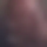 Chatta con yedel9659683423